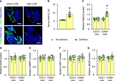 Epigenetically altered macrophages promote development of diabetes-associated atherosclerosis